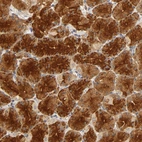 Immunohistochemical staining of human Stomach shows strong granular cytoplasmic positivity in glandular cells.