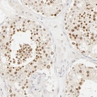 Anti-KIF2A Antibody