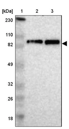 Lane 1: Marker [kDa] 230, 110, 82, 49, 32, 26, 18_br/_Lane 2: Human cell line RT-4_br/_Lane 3: Human cell line U-251MG sp