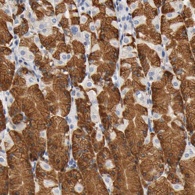 Anti-UCKL1 Antibody