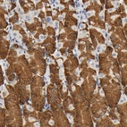 Anti-UCKL1 Antibody