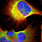 Immunofluorescent staining of human cell line U-251 MG shows localization to endoplasmic reticulum.