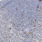 Immunohistochemical staining of human spleen shows strong membranous positivity in cells in white pulp.