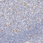 Immunohistochemical staining of human tonsil shows moderate membranous positivity in germinal center cells.