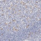 Immunohistochemical staining of human tonsil shows moderate membranous positivity in germinal center cells.