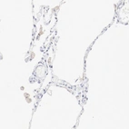 Immunohistochemical staining of human lung shows weak membranous and cytoplasmic positivity in macrophages.