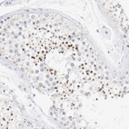 Immunohistochemical staining of human testis shows strong membranous and cytoplasmic positivity in spermatids.