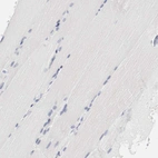 Immunohistochemical staining of human skeletal muscle shows no membranous positivity in myocytes as expected.