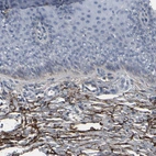 Immunohistochemical staining of human uterine cervix shows strong positivity in the extracellular matrix.
