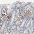 Immunohistochemical staining of human stomach shows moderate positivity in extracellular matrix.