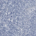 Immunohistochemical staining of human tonsil shows no positivity as expected.