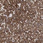 Anti-HMGCL Antibody