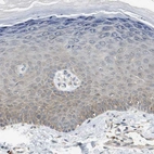 Immunohistochemical staining of human skin shows low expression as expected.