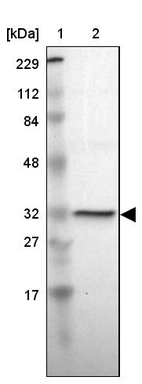 Lane 1: Marker [kDa] 229, 112, 84, 48, 32, 27, 17_br/_Lane 2: Human cell line RT-4