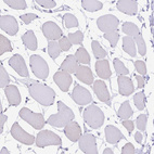 Anti-TGM3 Antibody