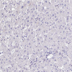 Anti-TGM3 Antibody