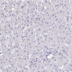 Immunohistochemical staining of human liver shows negative cytoplasmic positivity in hepatocytes.
