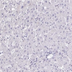 Immunohistochemical staining of human liver shows negative cytoplasmic positivity in hepatocytes.