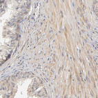 Anti-PDE5A Antibody