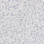 Immunohistochemical staining of human liver shows no positivity in hepatocytes as expected.