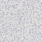 Anti-PDE5A Antibody