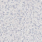Immunohistochemical staining of human liver shows no positivity in hepatocytes as expected.
