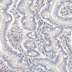 Immunohistochemical staining of human small intestine shows weak to moderate nuclear positivity in lymphoid cells.