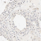 Immunohistochemical staining of human testis shows no positivity in cells in seminiferous ducts as expected.