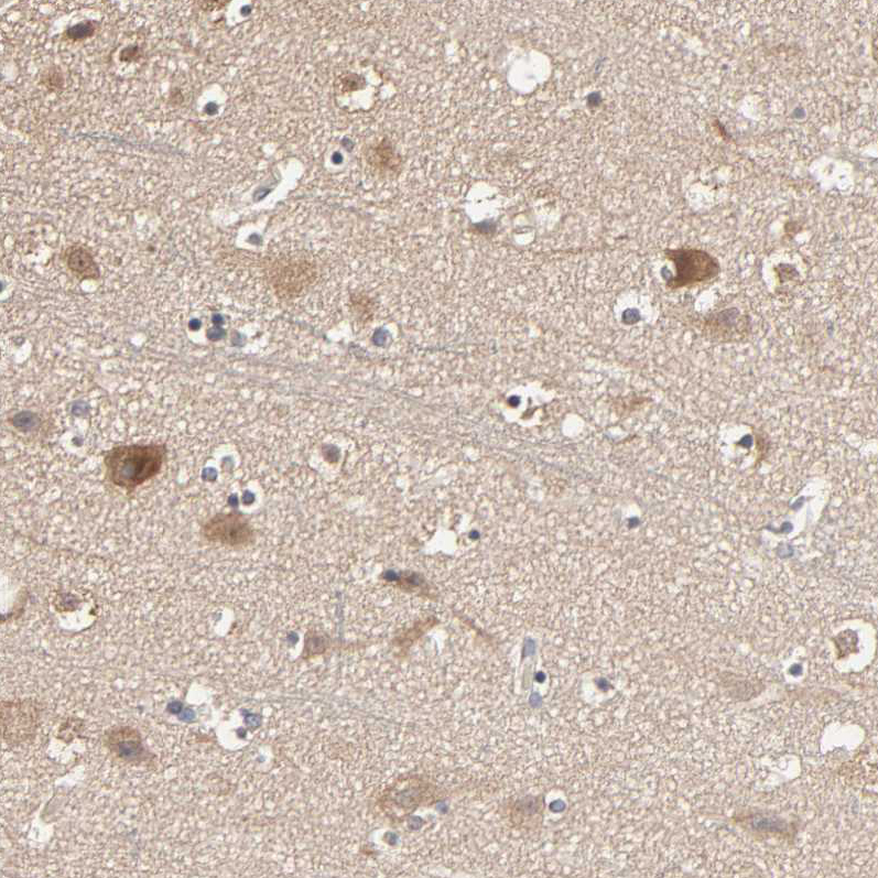 Anti-ARHGEF7 Antibody