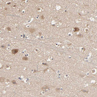 Anti-ARHGEF7 Antibody