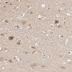 Anti-ARHGEF7 Antibody