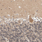 Immunohistochemical staining of human cerebellum shows moderate cytoplasmic positivity in Purkinje cells.
