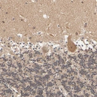 Immunohistochemical staining of human cerebellum shows moderate cytoplasmic positivity in Purkinje cells.