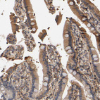 Immunohistochemical staining of human duodenum shows moderate cytoplasmic positivity in glandular cells.