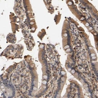Immunohistochemical staining of human duodenum shows moderate cytoplasmic positivity in glandular cells.