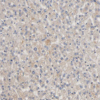 Immunohistochemical staining of human liver shows weak cytoplasmic positivity in hepatocytes.