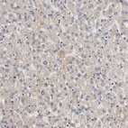 Immunohistochemical staining of human liver shows weak cytoplasmic positivity in hepatocytes.