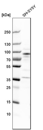 Western blot analysis in human cell line SH-SY5Y.