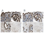 Immunohistochemical staining of human colon, placenta, prostate and skeletal muscle using Anti-FLNB antibody HPA004747 (A) shows similar protein distribution across tissues to independent antibody HPA004886 (B).