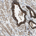 Anti-FLNB Antibody