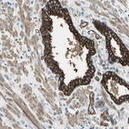 Immunohistochemical staining of human prostate shows strong membranous positivity in glandular cells.