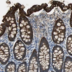 Immunohistochemical staining of human colon shows strong membranous positivity in glandular cells.