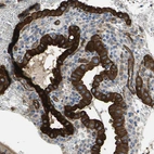 Immunohistochemical staining of human placenta shows strong membranous positivity in trophoblastic cells.