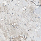 Immunohistochemical staining of human skeletal muscle shows low expression in myocytes as expected.