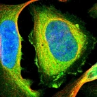 Immunofluorescent staining of human cell line U-2 OS shows localization to plasma membrane & cytosol.