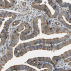 Immunohistochemical staining of human fallopian tube shows strong cytoplasmic positivity in glandular cells.