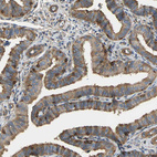 Anti-TLN1 Antibody