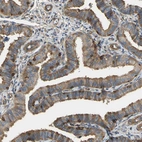 Immunohistochemical staining of human fallopian tube shows strong cytoplasmic positivity in glandular cells.