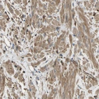 Immunohistochemical staining of human prostate shows moderate cytoplasmic positivity in smooth muscle cells.