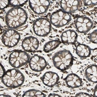 Immunohistochemical staining of human gastrointestinal shows very strong cytoplasmic positivity in glandular cells.